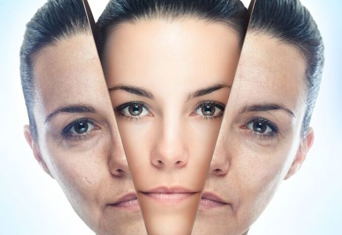 Процесс избавления кожи лица от возрастных изменений. 